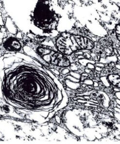Glutardialdehyde solution 25% for electron microscopy, purified and filled under nitrogen Merck