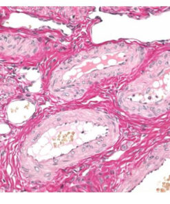 Weigert's iron hematoxylin kit for nuclear staining in connective tissue staining methods Merck